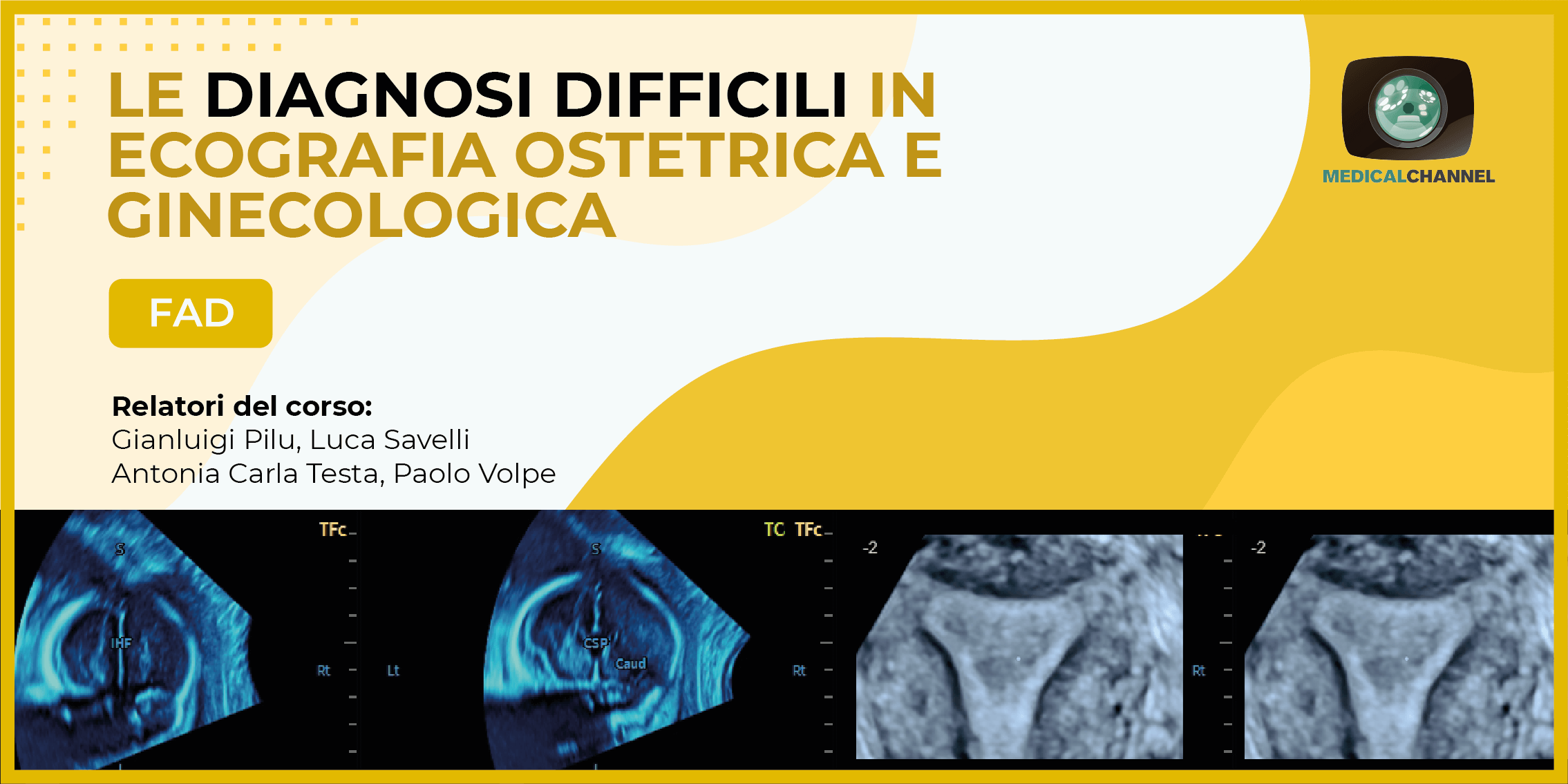 Le diagnosi difficili in ecografia ostetrica e ginecologica - FAD